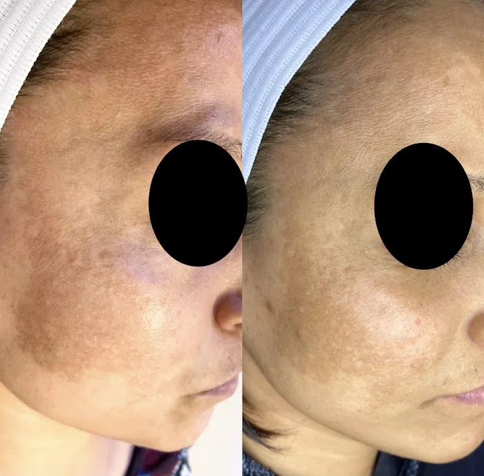 The Peel Connection Picture 2