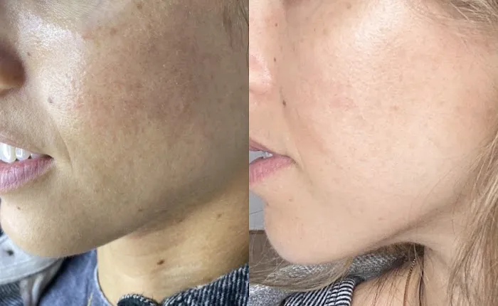 The Peel Connection Picture 3