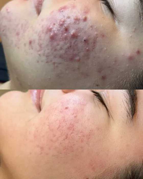 PurefectionLA Picture 8