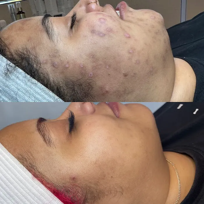 PurefectionLA Picture 4