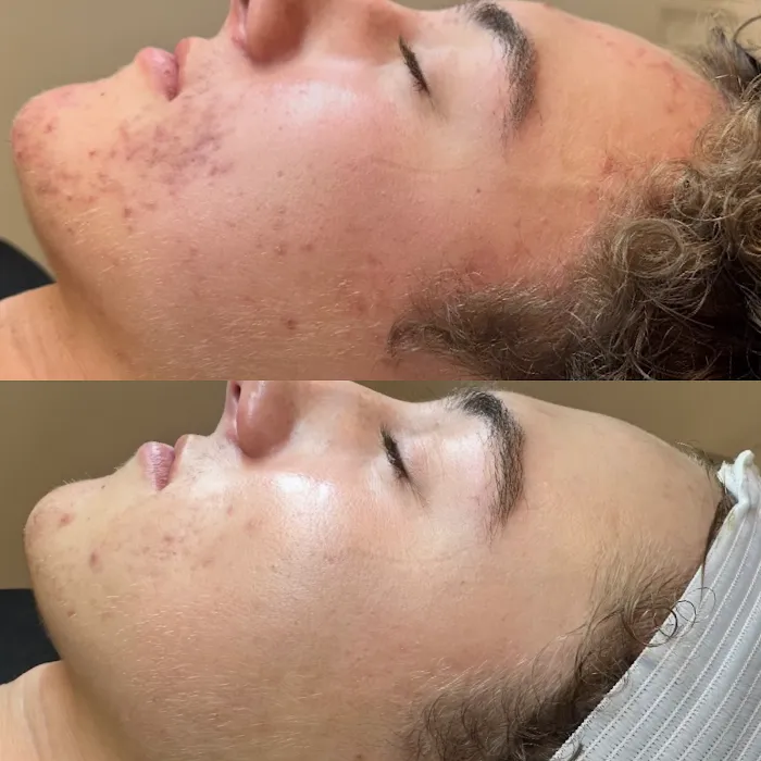 PurefectionLA Picture 9