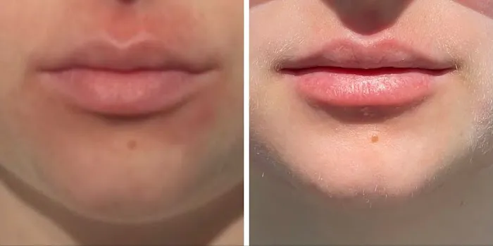 Skincare Crime Scene Picture 6