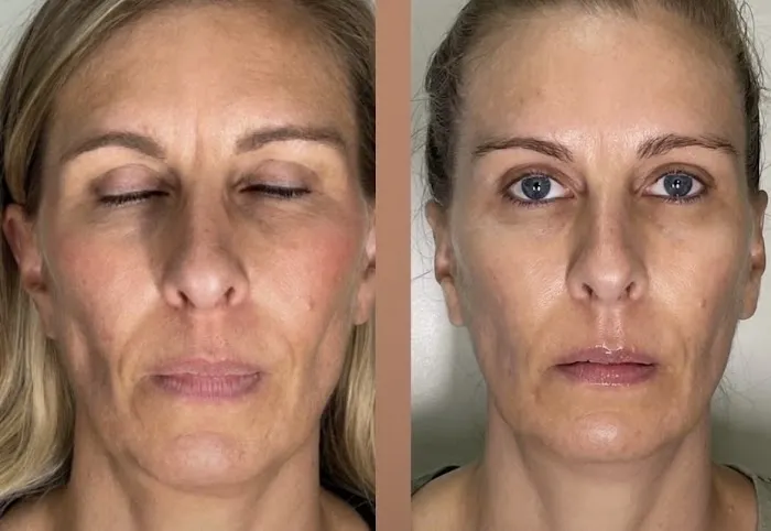 Skincare Crime Scene Picture 7