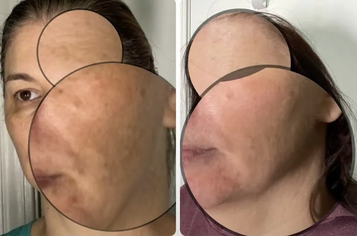 Skincare Crime Scene Picture 1