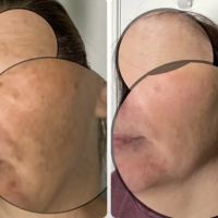 Skincare Crime Scene ico