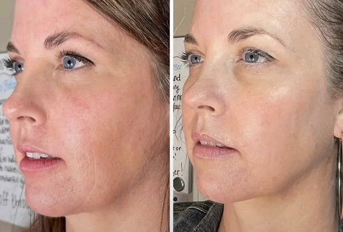 Skincare Crime Scene Picture 4