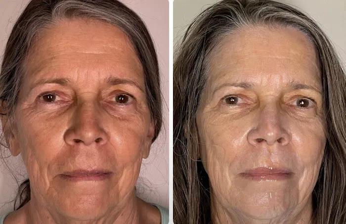 Skincare Crime Scene Picture 10