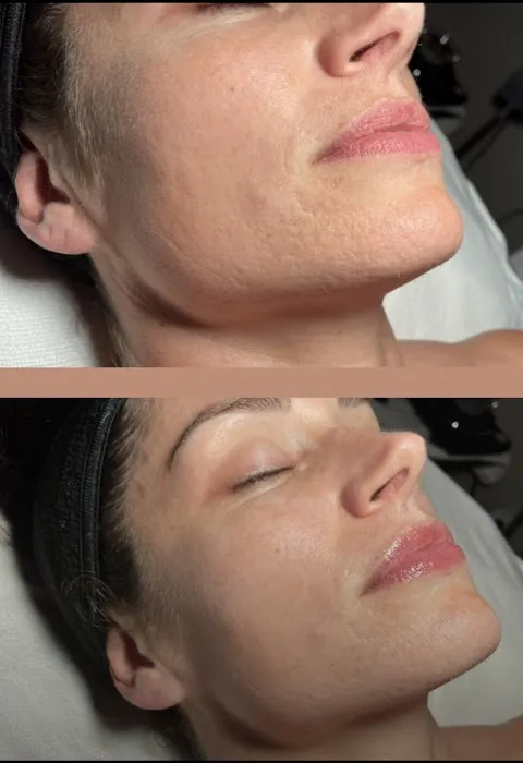 Skincare Crime Scene Picture 8