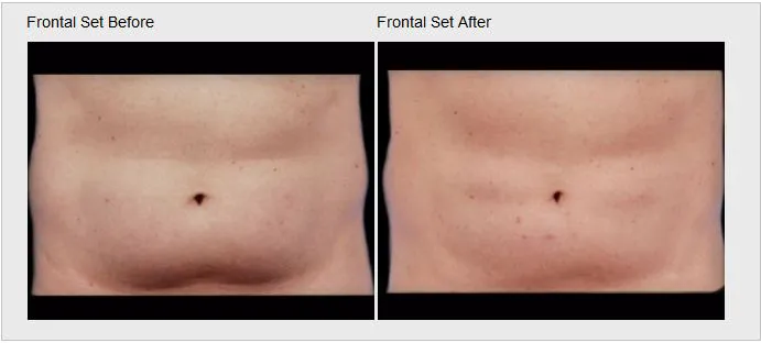 Skin Care and Laser Physicians of Beverly Hills Picture 3