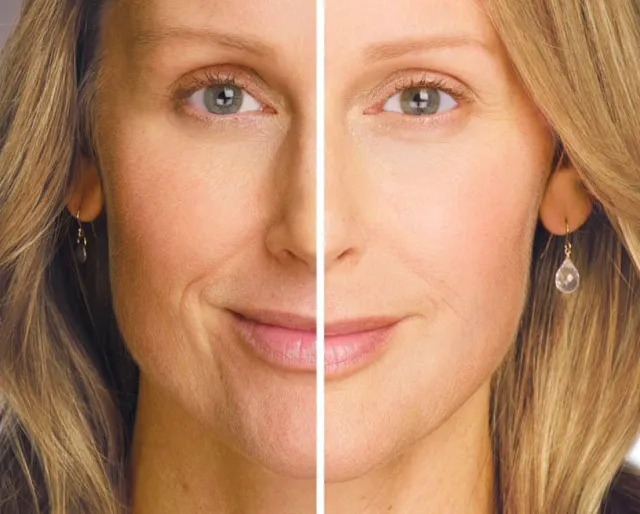 Skin Care and Laser Physicians of Beverly Hills Picture 1