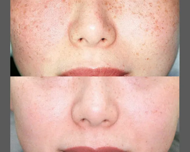 Skin Care and Laser Physicians of Beverly Hills Picture 6