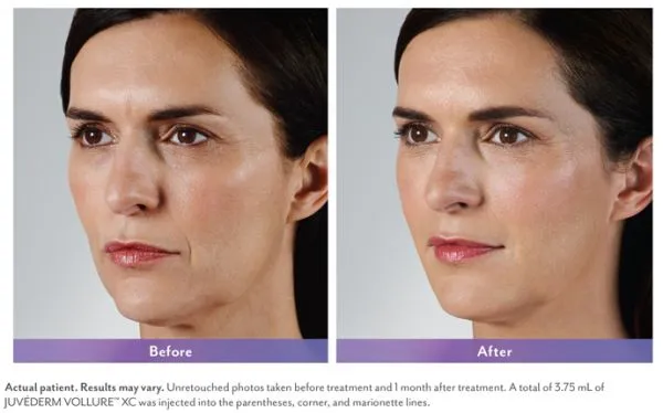 Skin Care and Laser Physicians of Beverly Hills Picture 7