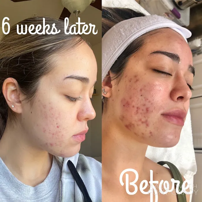 Skin Therapy by Kelly Picture 2