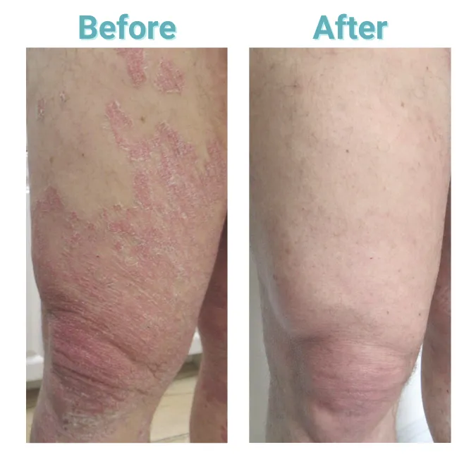 Array Skin Therapy Picture 9