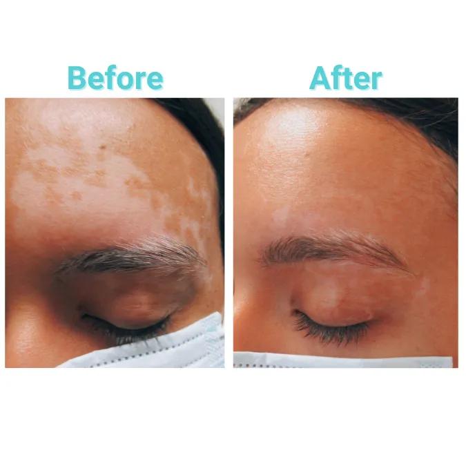 Array Skin Therapy Picture 6