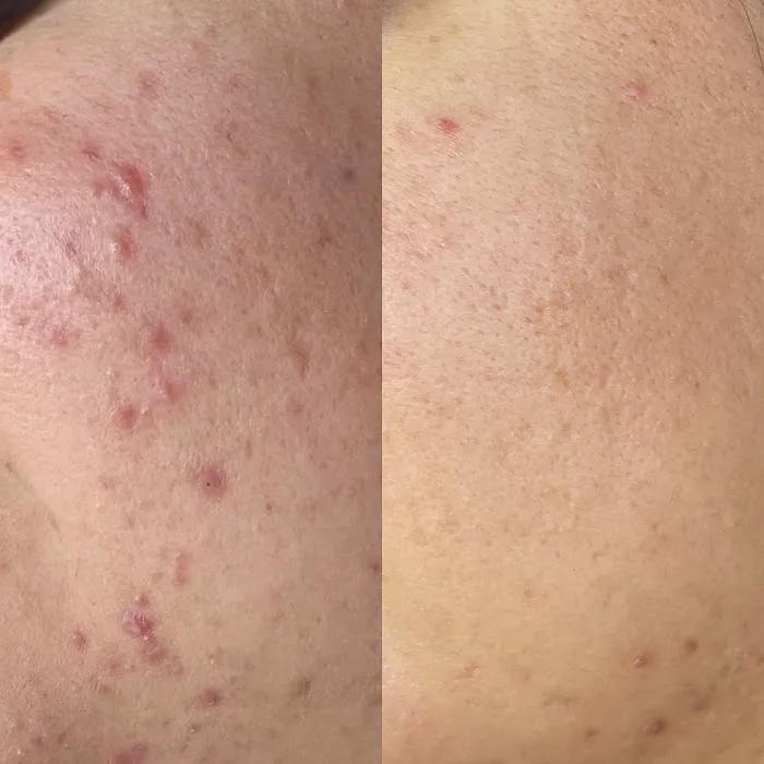 Helen Joyce Beauty Picture 4