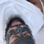 Redeem Skin Solution