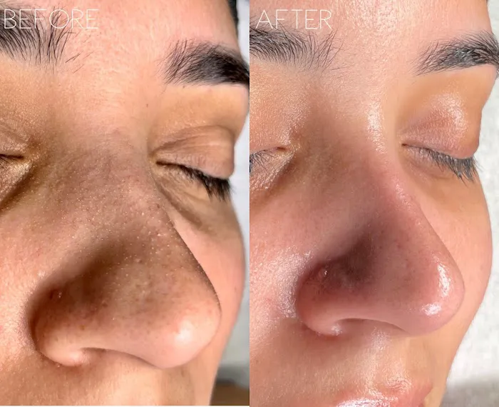 Redeem Skin Solution Picture 4