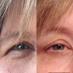Skin Rejuvenation Station