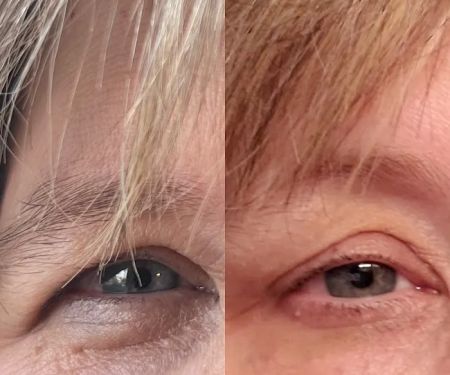 Skin Rejuvenation Station