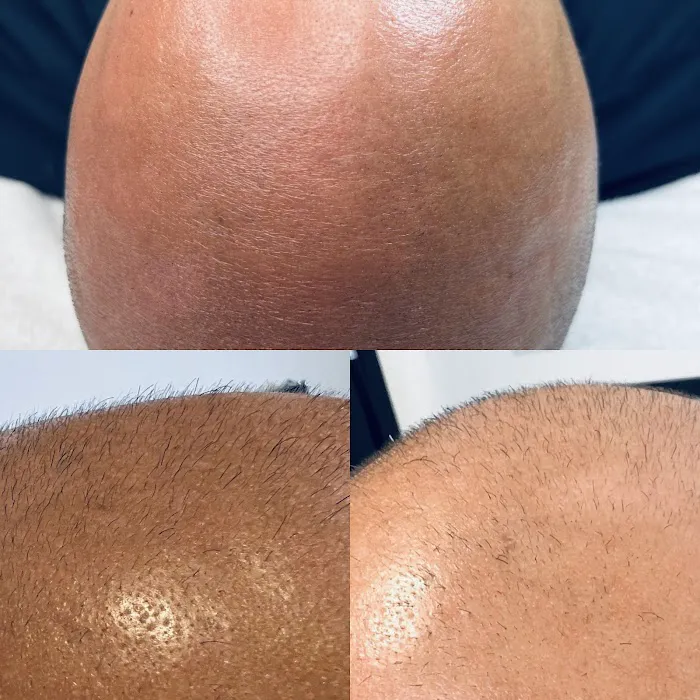 Skin Rejuvenation Station Picture 6