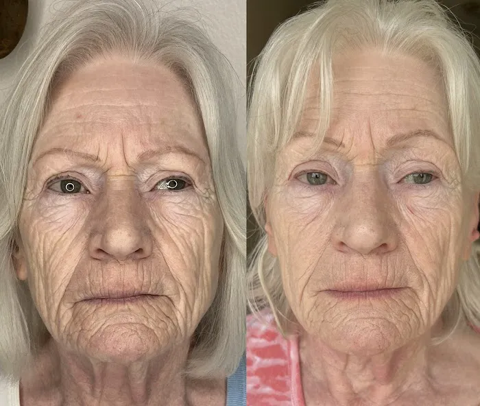 Skin Rejuvenation Station Picture 2