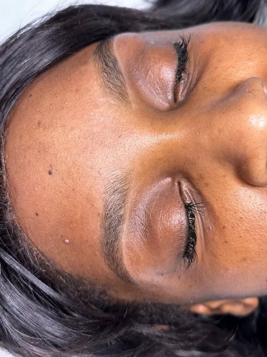 Lunaria Aesthetics Picture 3