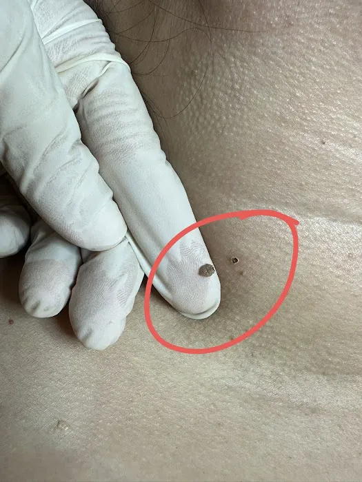 VVIP Beauty & Skin Care Picture 9