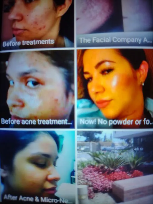 The Facial Company Acne Clinic Picture 3