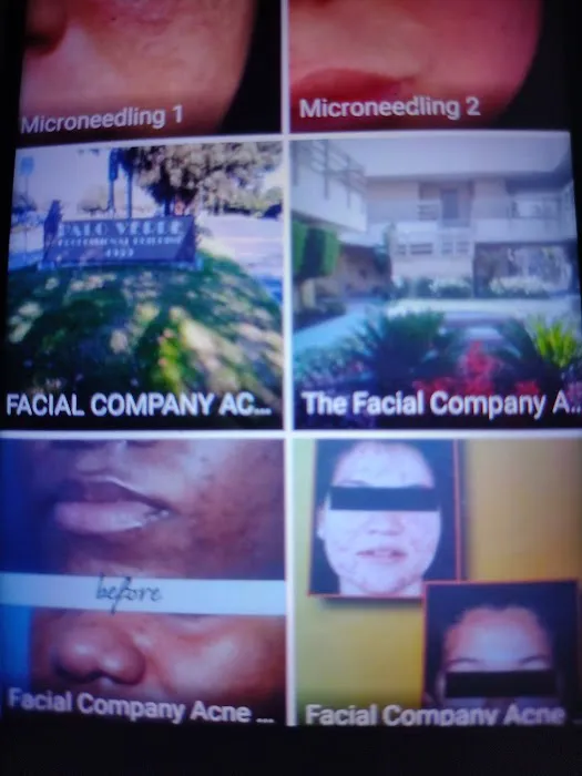 The Facial Company Acne Clinic Picture 1