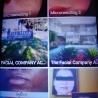 The Facial Company Acne Clinic ico