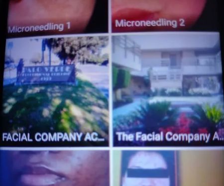 The Facial Company Acne Clinic