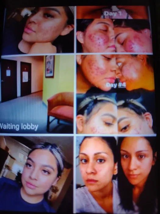 The Facial Company Acne Clinic Picture 2