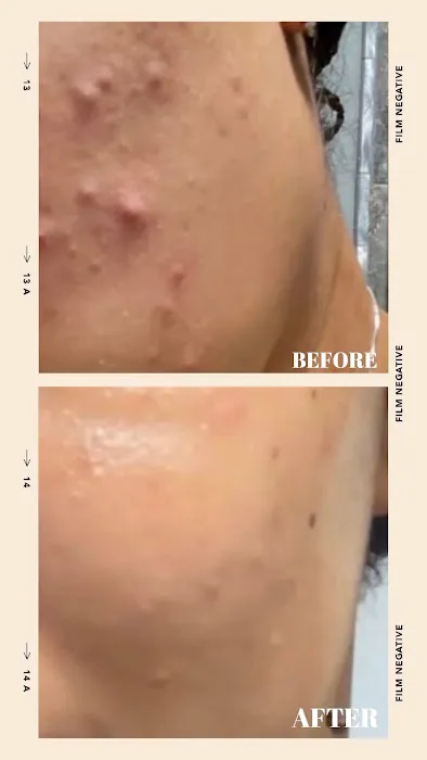 Restore Thy Skin Esthetics LLC Picture 2