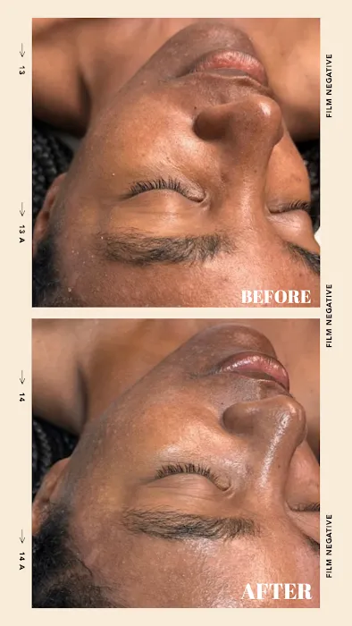Restore Thy Skin Esthetics LLC Picture 4
