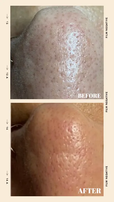 Restore Thy Skin Esthetics LLC Picture 5