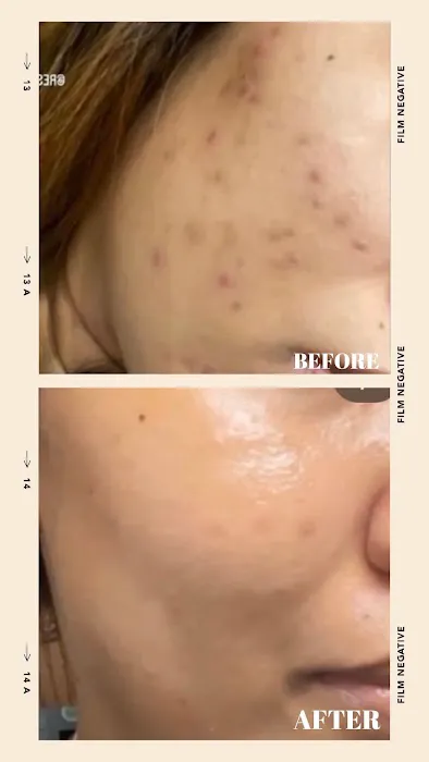 Restore Thy Skin Esthetics LLC Picture 3