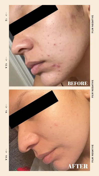 Restore Thy Skin Esthetics LLC Picture 6