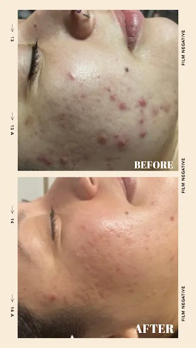 Restore Thy Skin Esthetics LLC Picture 7