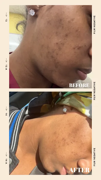 Restore Thy Skin Esthetics LLC Picture 8