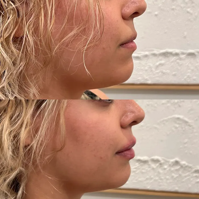 Aère Aesthetics Picture 3