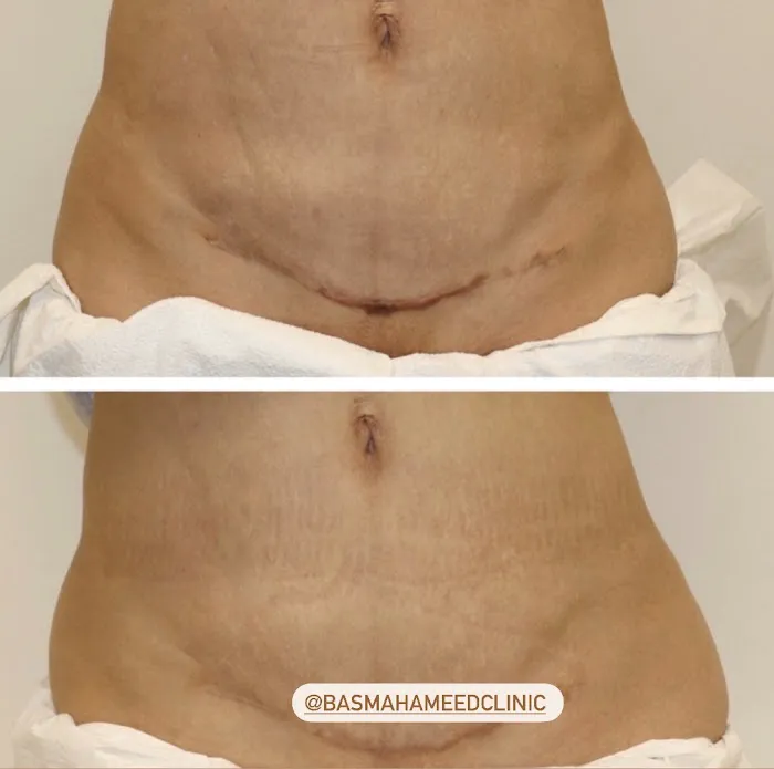 Basma Hameed Clinic Beverly Hills Picture 5