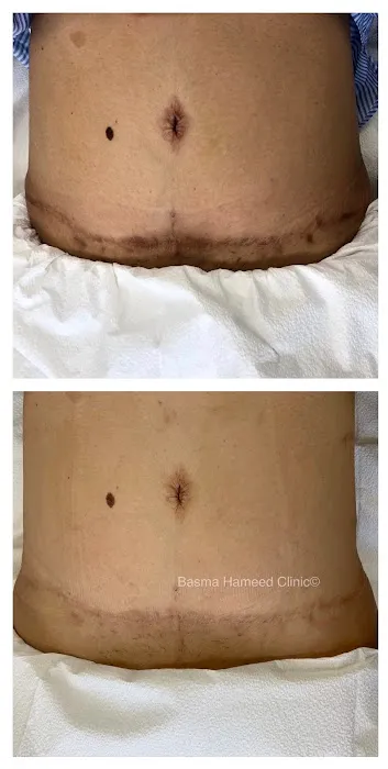 Basma Hameed Clinic Beverly Hills Picture 4