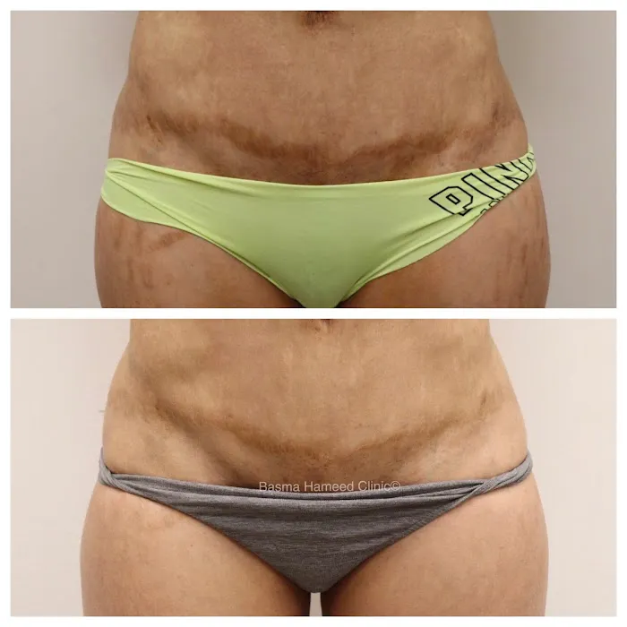 Basma Hameed Clinic Beverly Hills Picture 1