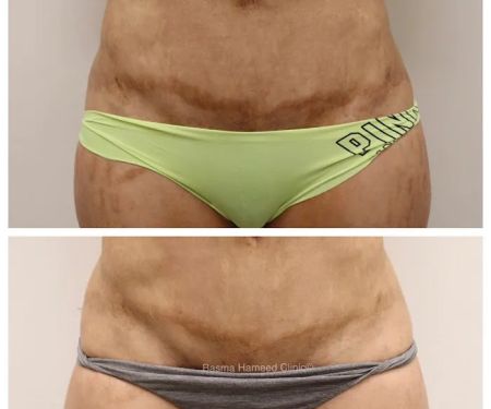 Basma Hameed Clinic Beverly Hills