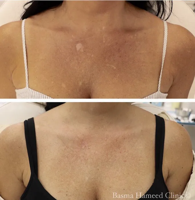 Basma Hameed Clinic Beverly Hills Picture 8