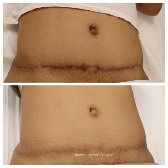 Basma Hameed Clinic Beverly Hills Picture 10