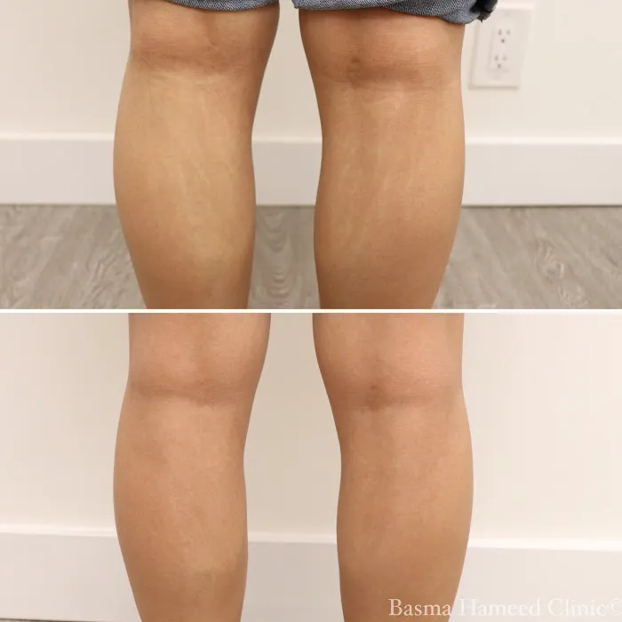 Basma Hameed Clinic Beverly Hills Picture 7