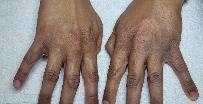 Marina’s Skin Health Picture 1