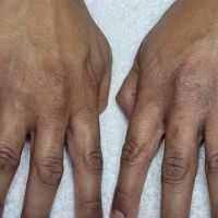 Marina’s Skin Health ico